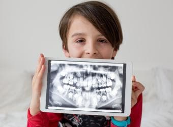 Are Dental X-Rays Safe for Children? Separating Fact from Fiction